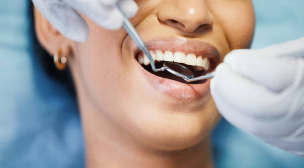 Best Emergency Root Canal Therapy in Violet, LA